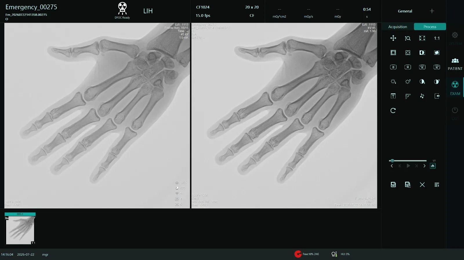 Fluoroscopy software showing last-image hold