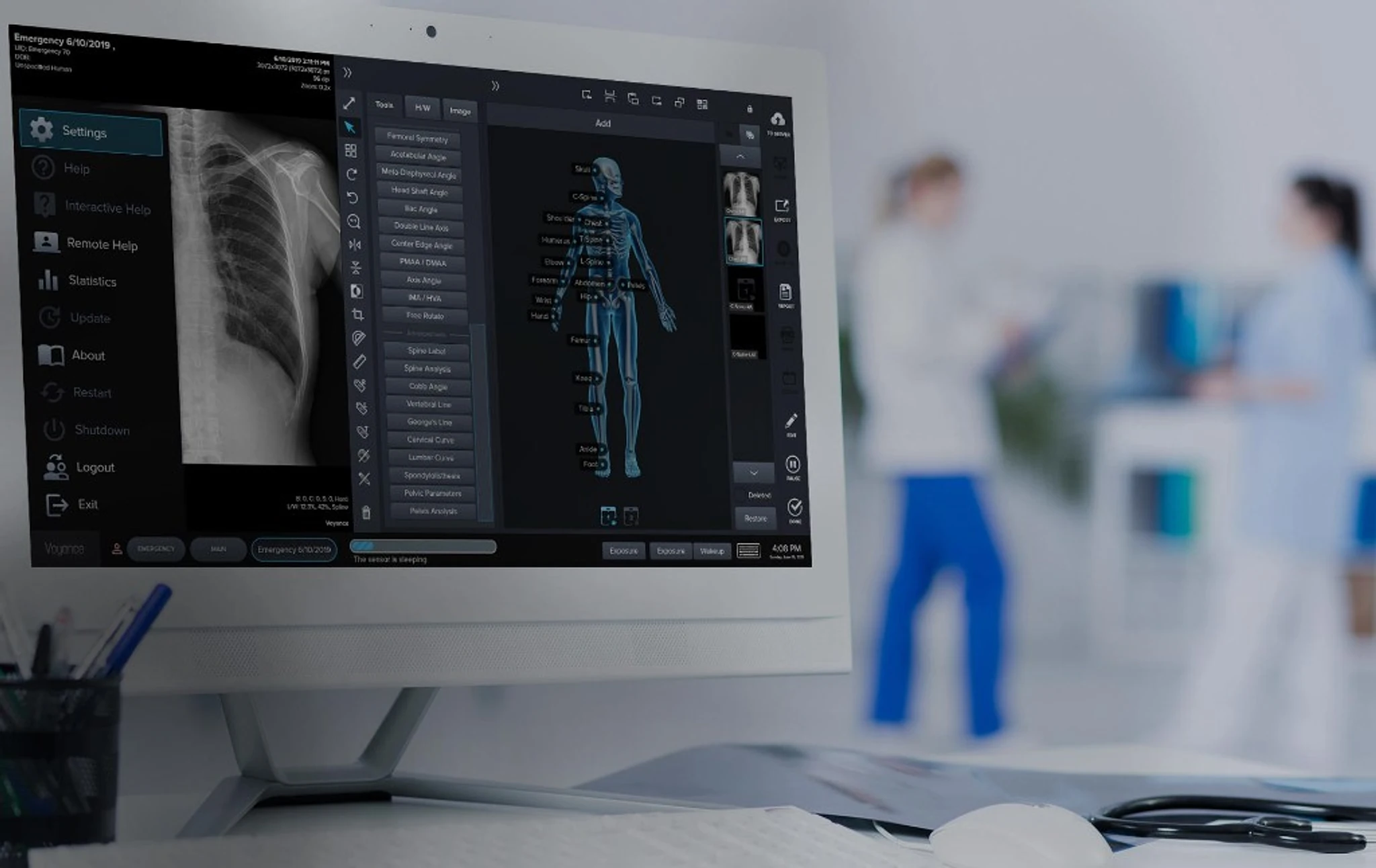 Radiograph open on the Voyance acquisition screen
