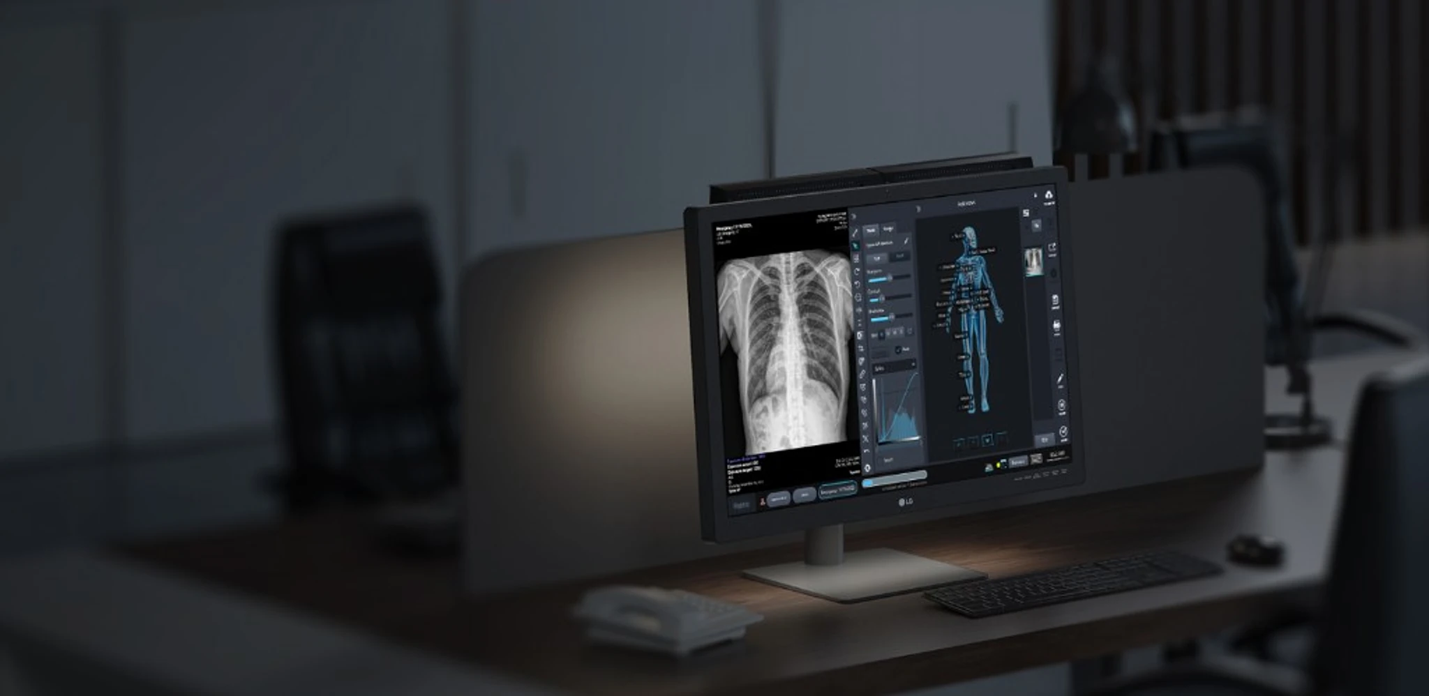 Workstation and software that come with a detector package