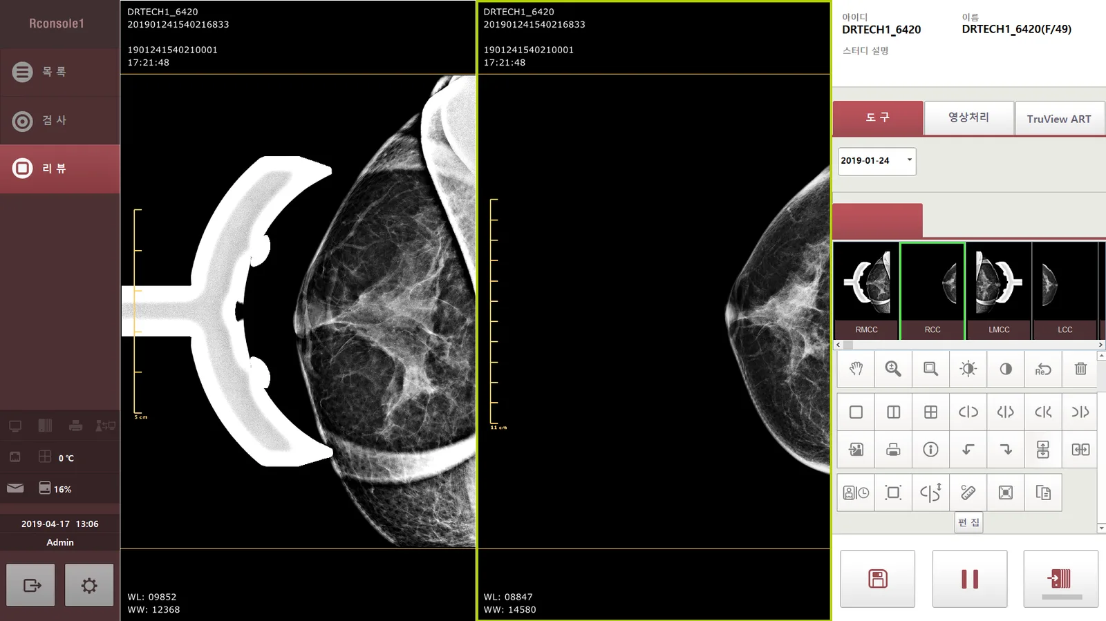 Mammography acquisition screen with image comparison